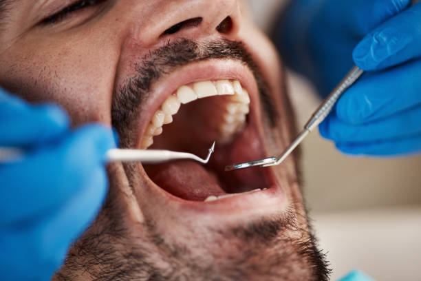 Best Holiday Emergency Dentist in Dover, FL