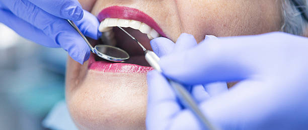 Best Weekend Emergency Dentist in Dover, FL