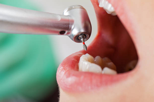 Best Emergency Cosmetic Dentistry in Dover, FL